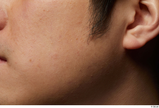 HD Face Skin Allvince Epps cheek ear face hair skin…